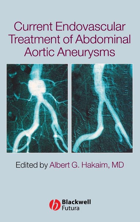 Produktbild: Current Endovascular Treatment of Abdominal Aortic Aneurysms