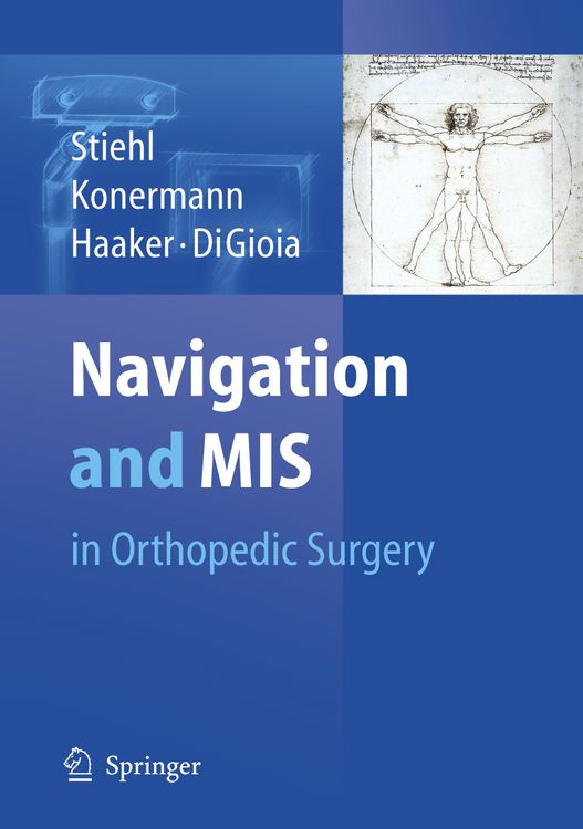 Produktbild: Navigation and MIS in Orthopedic Surgery