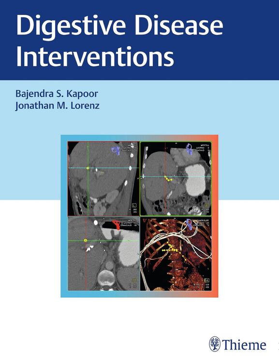 Produktbild: Digestive Disease Interventions