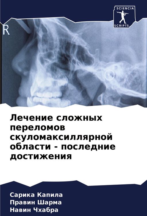 Produktbild: Lechenie slozhnyh perelomow skulomaxillqrnoj oblasti - poslednie dostizheniq