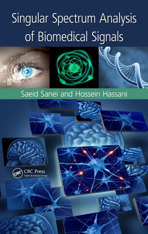 Produktbild: Singular Spectrum Analysis of Biomedical Signals