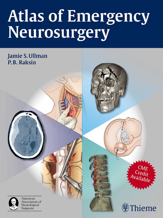 Produktbild: Atlas of Emergency Neurosurgery
