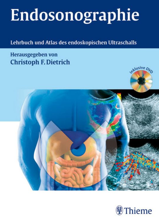 Produktbild: Endosonographie