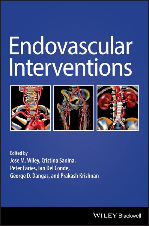 Produktbild: Endovascular Interventions