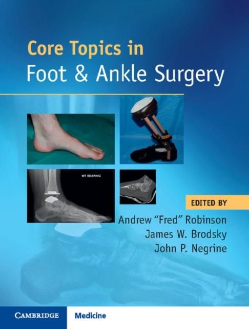 Produktbild: Core Topics in Foot and Ankle Surgery