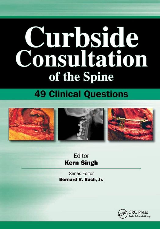 Produktbild: Curbside Consultation of the Spine