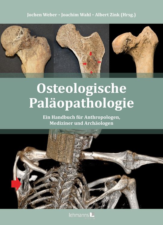 Produktbild: Osteologische Pal&auml;opathologie