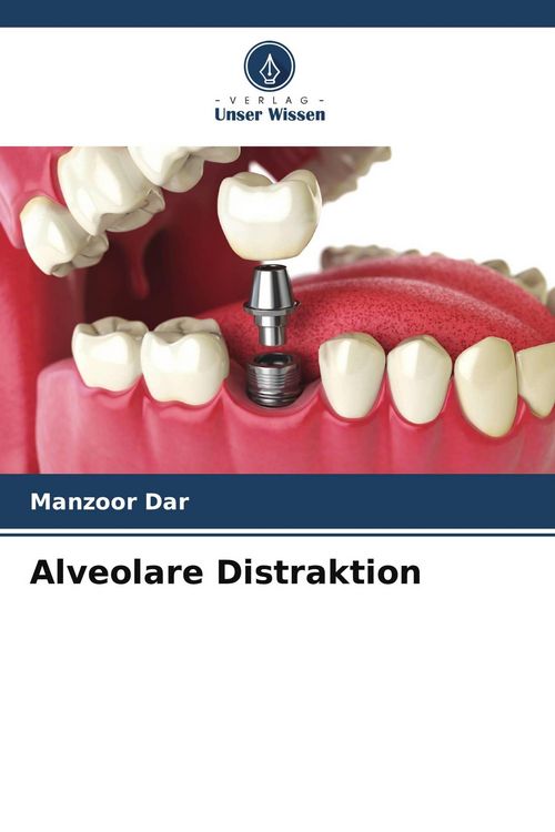 Produktbild: Alveolare Distraktion