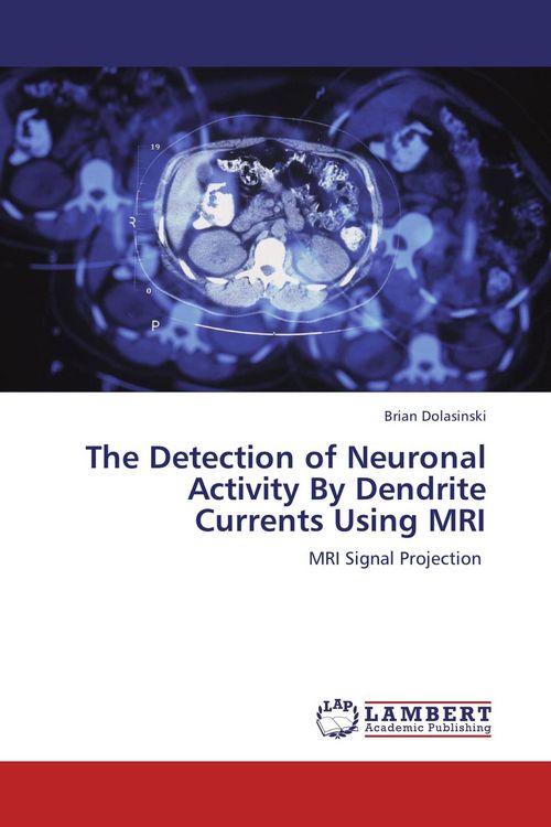 Produktbild: The Detection of Neuronal Activity By Dendrite Currents Using MRI