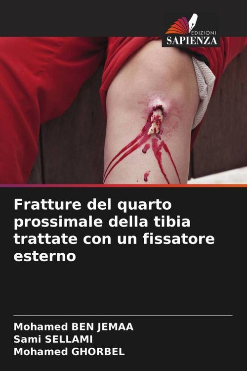Produktbild: Fratture del quarto prossimale della tibia trattate con un fissatore esterno