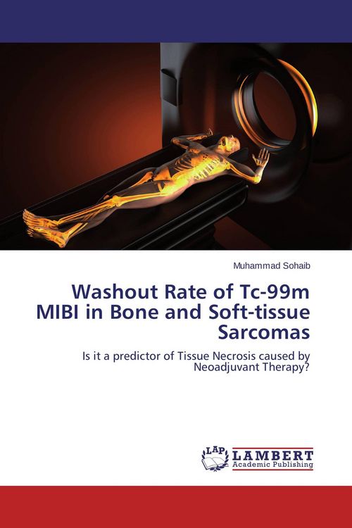 Produktbild: Washout Rate of Tc-99m MIBI in Bone and Soft-tissue Sarcomas