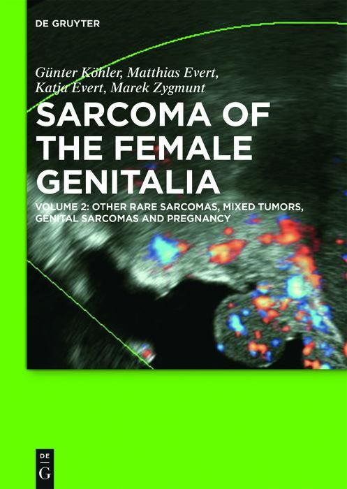 Produktbild: Other Rare Sarcomas, Mixed Tumors, Genital Sarcomas and Pregnancy