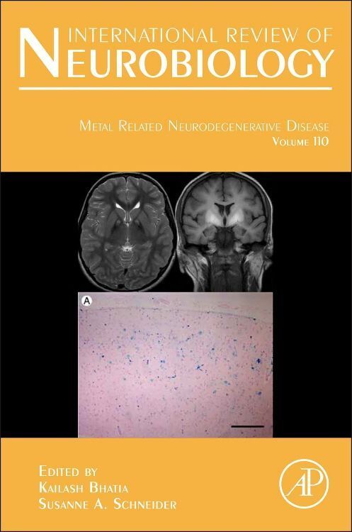 Produktbild: Metal Related Neurodegenerative Disease