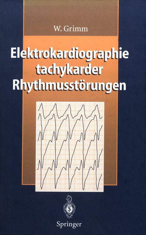 Produktbild: Elektrokardiographie tachykarder Rhythmusst&ouml;rungen