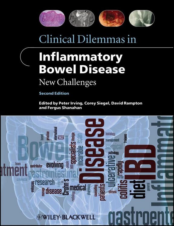 Produktbild: Clinical Dilemmas in Inflammatory Bowel Disease