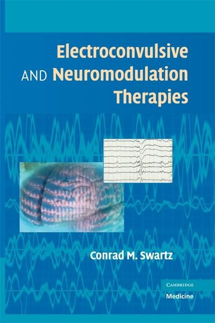 Produktbild: Electroconvulsive and Neuromodulation Therapies