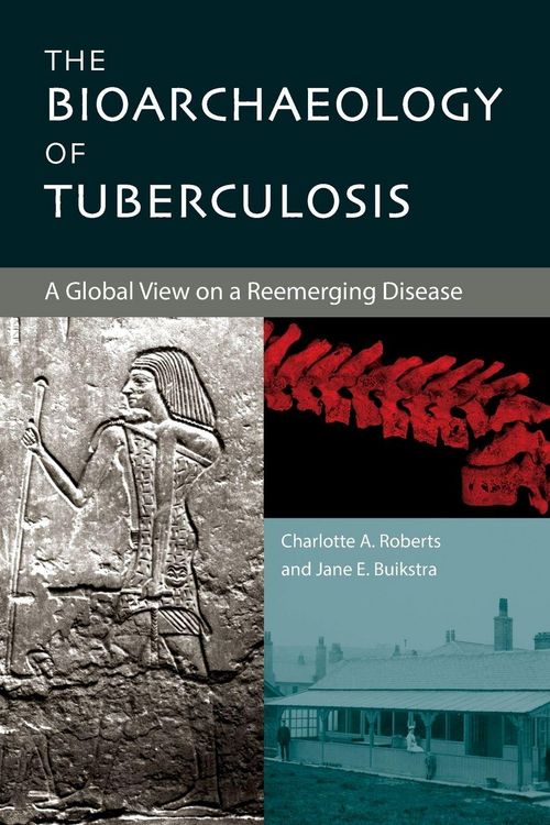 Produktbild: The Bioarchaeology of Tuberculosis
