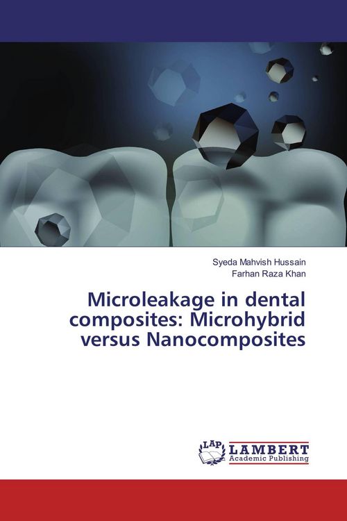 Produktbild: Microleakage in dental composites: Microhybrid versus Nanocomposites