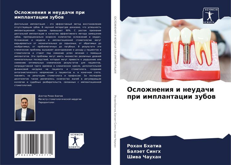 Produktbild: Oslozhneniq i neudachi pri implantacii zubow