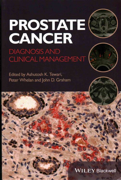 Produktbild: Prostate Cancer