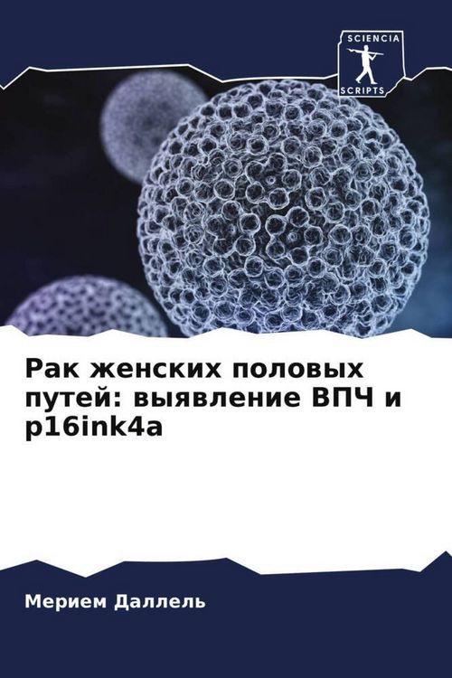 Produktbild: Rak zhenskih polowyh putej: wyqwlenie VPCh i p16ink4a
