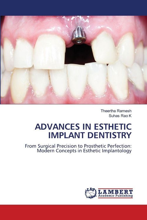 Produktbild: Advances in Esthetic Implant Dentistry