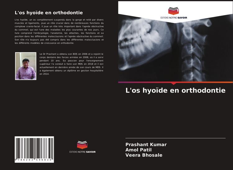 Produktbild: L'os hyo&iuml;de en orthodontie