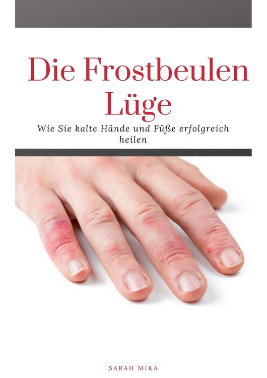 Produktbild: Die Frostbeulen L&uuml;ge