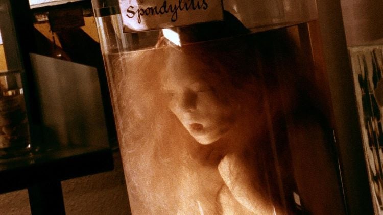 Produktbild: Geister: Die komplette Serie (Lars von Trier) [7 BRs]