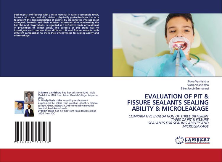 Produktbild: EVALUATION OF PIT & FISSURE SEALANTS SEALING ABILITY & MICROLEAKAGE