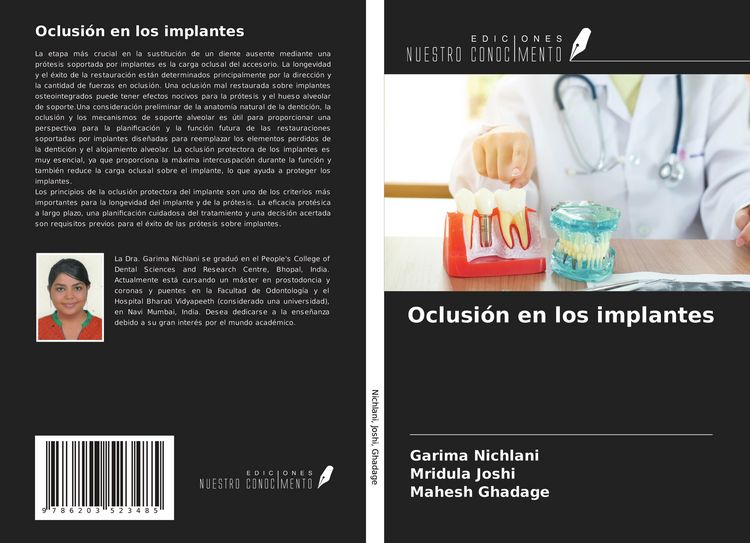 Produktbild: Oclusi&oacute;n en los implantes