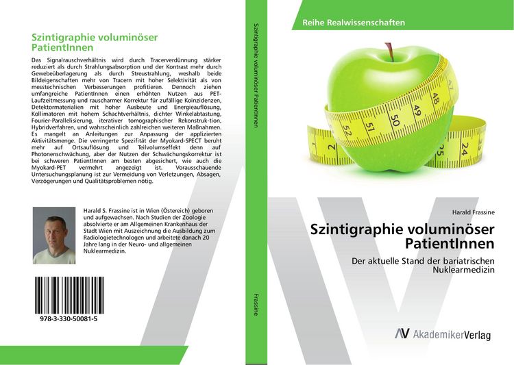 Produktbild: Szintigraphie volumin&ouml;ser PatientInnen