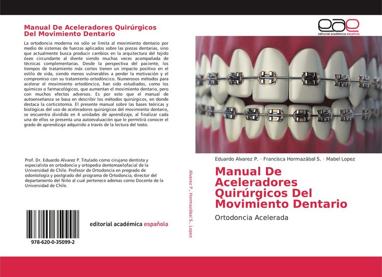Produktbild: Manual De Aceleradores Quir&uacute;rgicos Del Movimiento Dentario