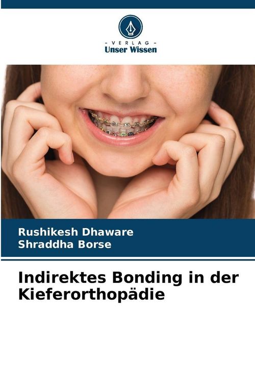 Produktbild: Indirektes Bonding in der Kieferorthop&auml;die