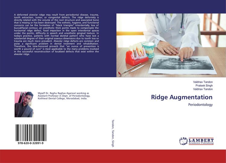 Produktbild: Ridge Augmentation
