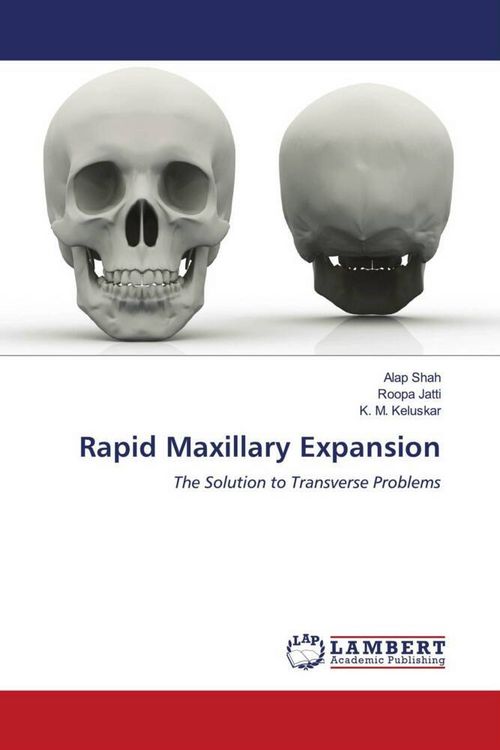 Produktbild: Rapid Maxillary Expansion