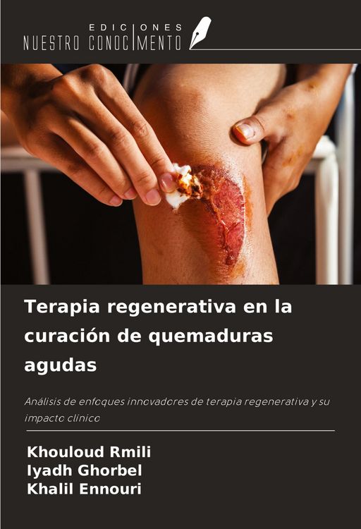 Produktbild: Terapia regenerativa en la curaci&oacute;n de quemaduras agudas