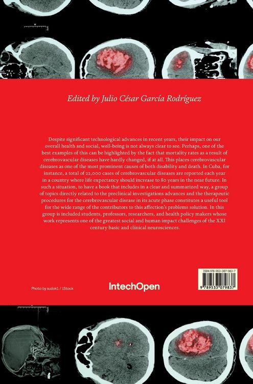 Produktbild: Acute Ischemic Stroke