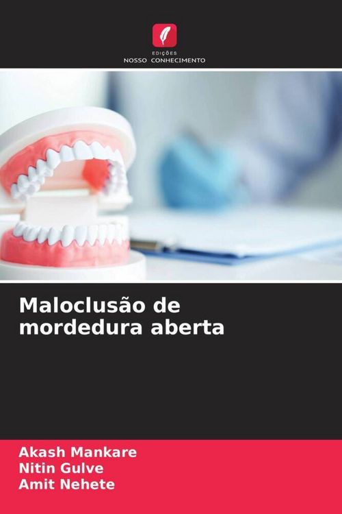 Produktbild: Maloclus&atilde;o de mordedura aberta