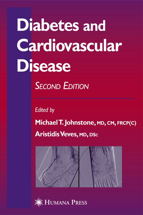 Produktbild: Diabetes and Cardiovascular Disease