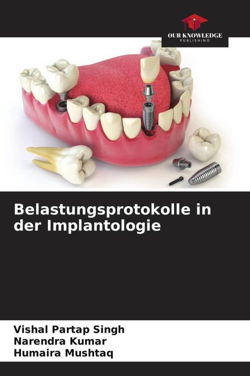 Produktbild: Belastungsprotokolle in der Implantologie