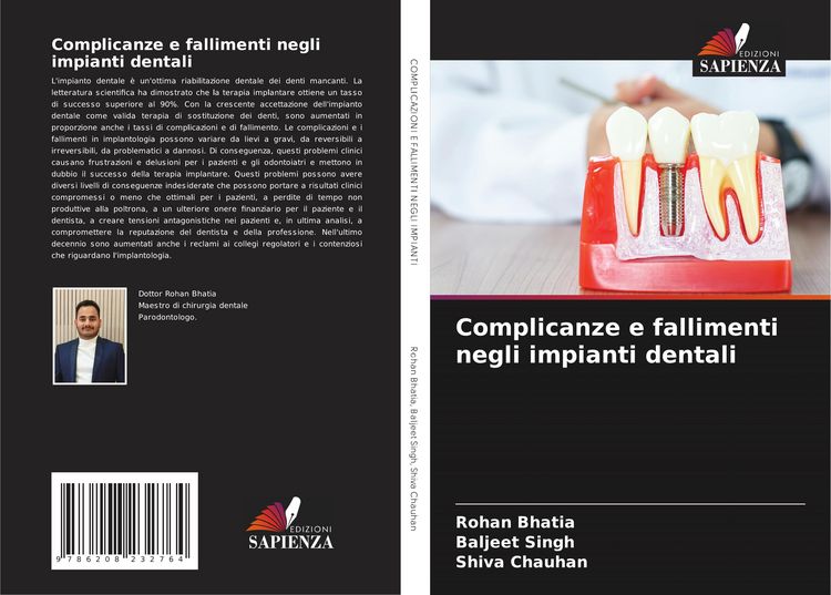 Produktbild: Complicanze e fallimenti negli impianti dentali