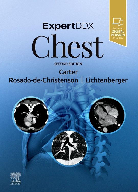 Produktbild: Expertddx: Chest