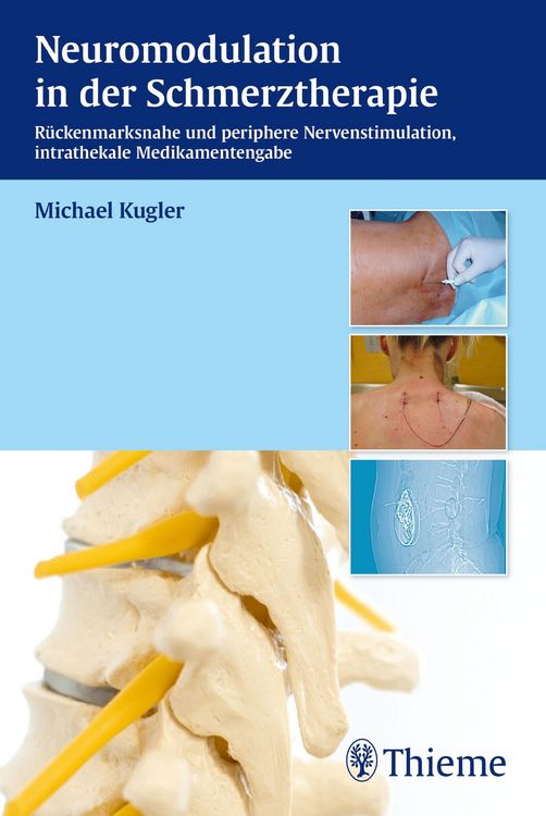 Produktbild: Neuromodulation in der Schmerztherapie
