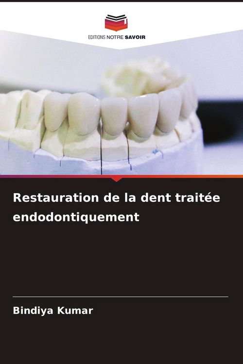 Produktbild: Restauration de la dent trait&eacute;e endodontiquement