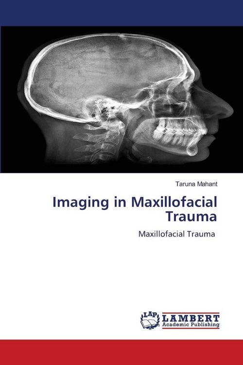 Produktbild: Imaging in Maxillofacial Trauma