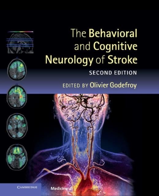 Produktbild: Behavioral and Cognitive Neurology of Stroke