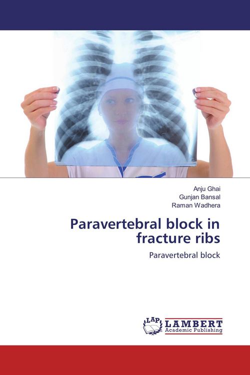 Produktbild: Paravertebral block in fracture ribs