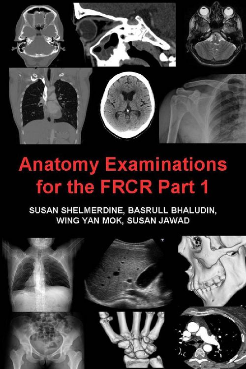 Produktbild: Anatomy Examinations for the FRCR Part 1