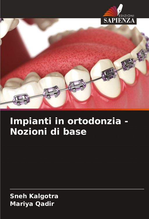 Produktbild: Impianti in ortodonzia - Nozioni di base